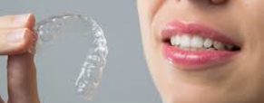 The Expert Touch: Why Choose an Orthodontist for Invisalign?