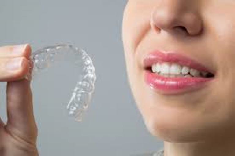 The Expert Touch: Why Choose an Orthodontist for Invisalign?